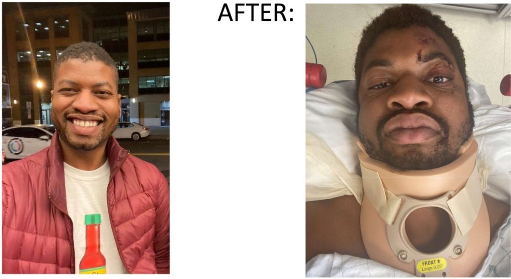 “a bicyclist was critically injured in a hit-and-run bicycle crash on ...